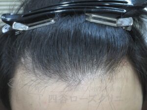 治療後