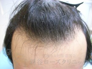 治療前